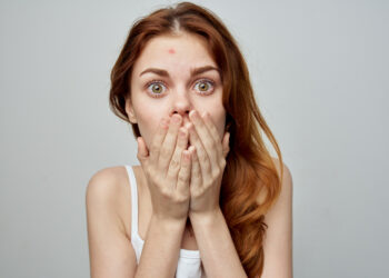 Jak pozbyć się pryszczy – skuteczne metody walki z niedoskonałościami skóry?